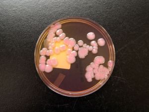 A lab specimen of antibiotic-resistant Enterobacter cloacae, which belongs to a family of infectious bacteria, known as CRE, that defies even drugs of last resort.