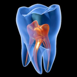 Curso de Microbiología Endodóntica (Especialidad en Endodoncia)